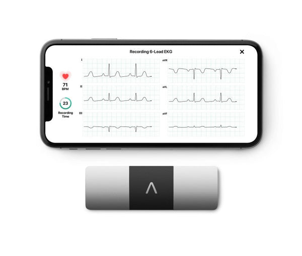 Kardia Mobile 6L: Kompleksowy przewodnik po przenośnym urządzeniu EKG - Mój Kardiolog