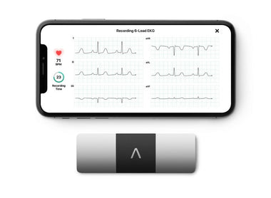 Kardia Mobile 6L: Kompleksowy przewodnik po przenośnym urządzeniu EKG