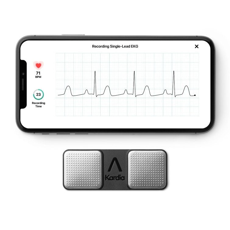 KardiaMobile 1 - odprowadzeniowe EKG AliveCor - Mój Kardiolog