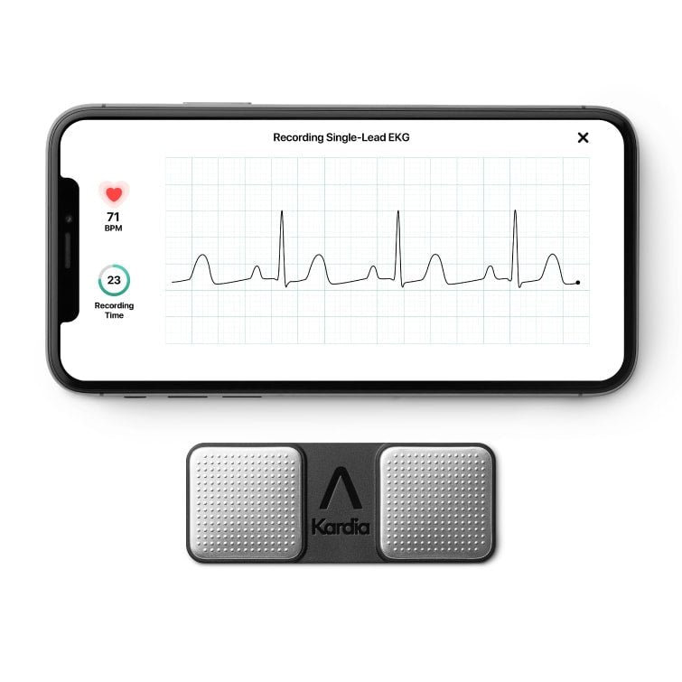 KardiaMobile 1-odprowadzeniowe EKG AliveCor - Mój Kardiolog