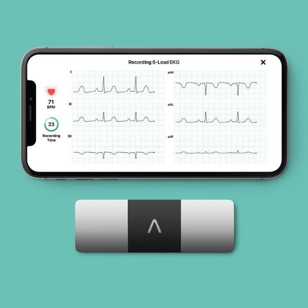KardiaMobile 6-odprowadzeniowe EKG - Mój Kardiolog